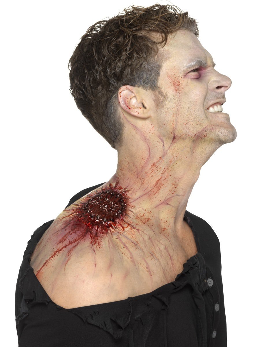 Latex Infected Bite Wound Prosthetic